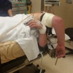 Elbow arthroscopy theatre positioning and setup