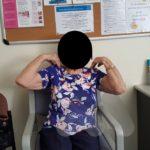 Movement after total elbow replacement