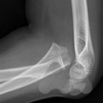 Screen Shot 2018-10-05 at 10.17.22 pm