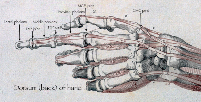Hand Osteoarthritis - Avanthi Mandaleson
