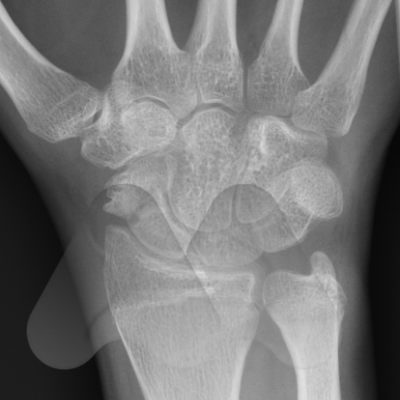 Screen Shot 2020-06-08 at 3.17.26 pm