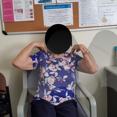 Movement after total elbow replacement